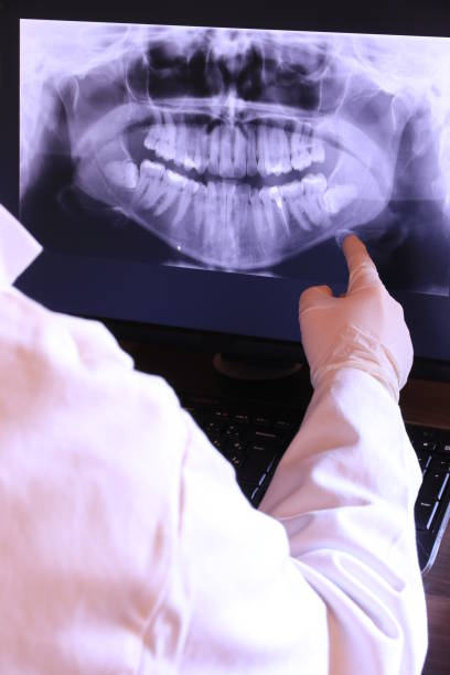Best Emergency Dental Care for Broken or Chipped Teeth in Kendall West, FL